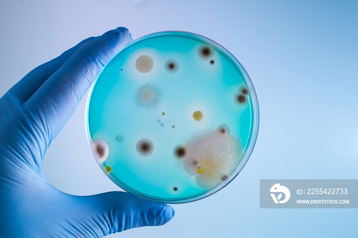 technician with bacterias sample in petri dish / Hands of doctor with petri plate in the laboratory