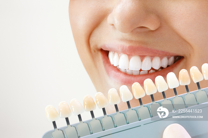 Smiling young woman. Cosmetological teeth whitening in a dental clinic. selection of the tone of the implant tooth