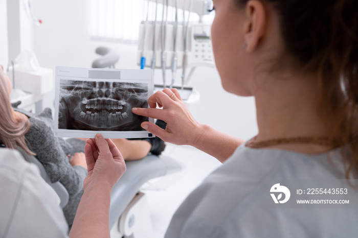 female dentist looks at an x-ray of the patient’s teeth, doctor says which teeth to treat. Modern dental office. x-ray of the jaw