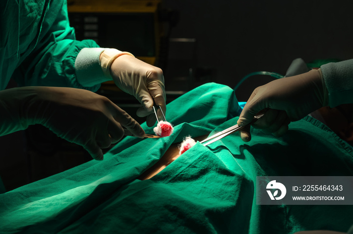 A team of doctors operates on the life of a middle-aged man in a hospital operating room. Heart transplant surgery. thoracic surgery and surgery on the abdomen and breasts. Cosmetic breast surgery.