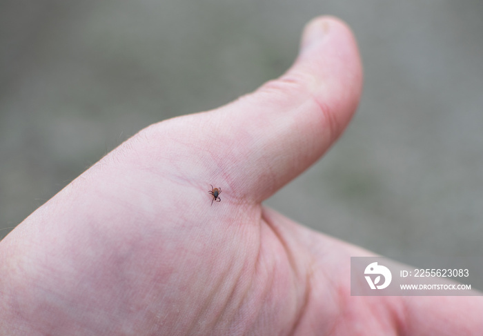 Tick in the palm of a man. Tick season - concept.