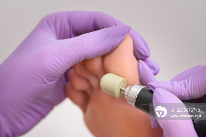 Foot skin treatment process. Gloved hands with a pedicure machine. Close-up