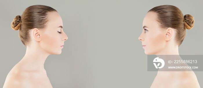 Female Nose Before and After Cosmetic Surgery or Retouch. Rhinoplasty, Beauty and Cosmetology Concept