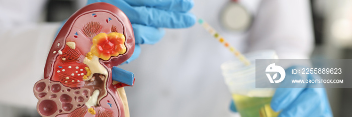 Artificial model of kidney and ureter of human standing on table of urologist doctor with urine test closeup