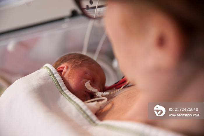 A mother holds her two days old premature boy by the side of the incubator in a neonatal nursery.