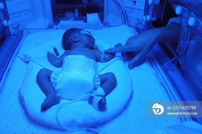 母亲在保温箱（新生儿重症监护室）里用手触摸她的小儿子。孩子有t