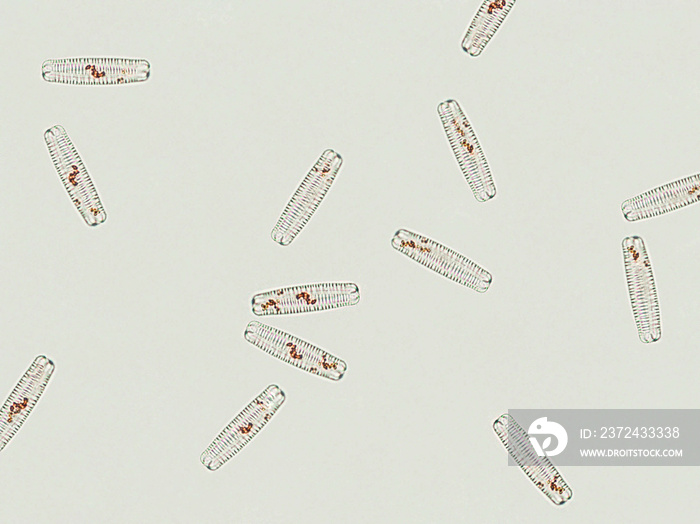 显微镜下的硅藻