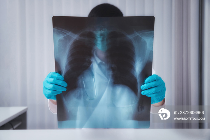 A doctor is diagnosing the results of the lung X-rays of patients infected with the coronavirus.