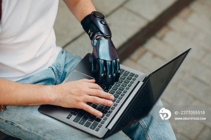 Young disabled man with artificial prosthetic hand using typing on laptop computer keyboard