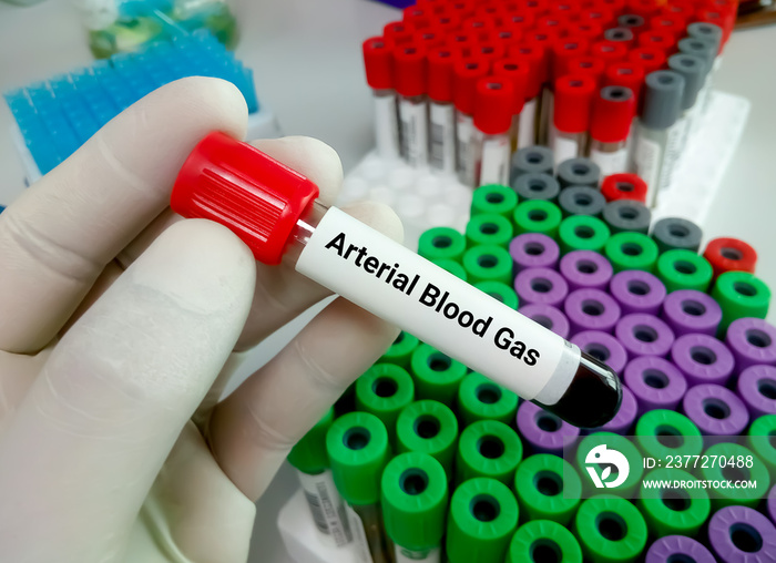 Blood sample tube for arterial blood gas test