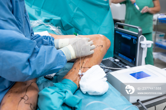 Process of varicose vein surgery in hospital, operating room, vein sealing, venous vascular surgery concept