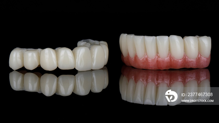 two excellent temporary dental prostheses of the upper and lower jaws on black glass