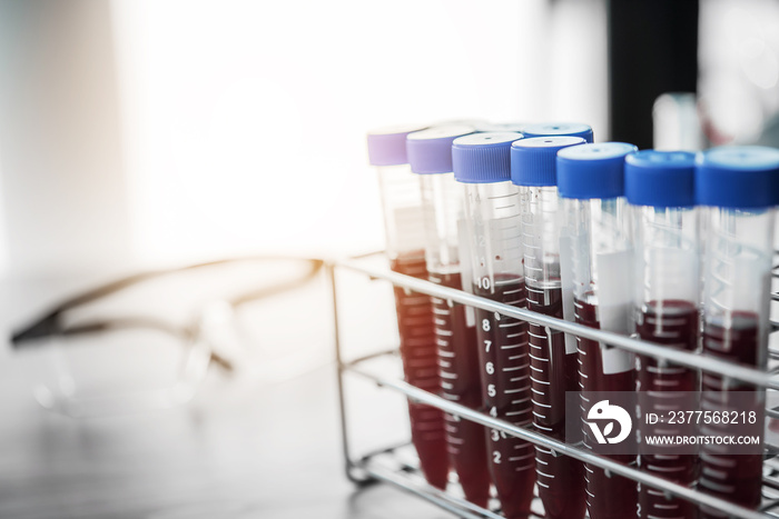 blood sample in test tube at laboratory. Medical, pharmaceutical and scientific research and develop