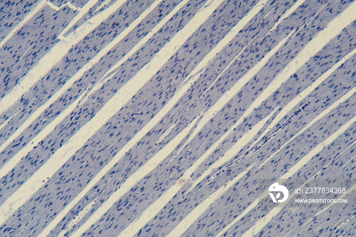 Human cardiac muscle under the microscope