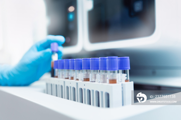 Macro photo hand of medical worker, Biochemical analyzer blood tests on modern equipment of laboratories