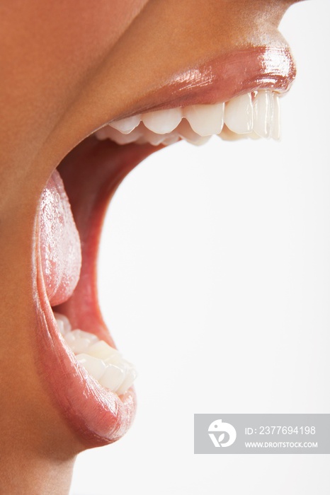 Woman Screaming On White Background