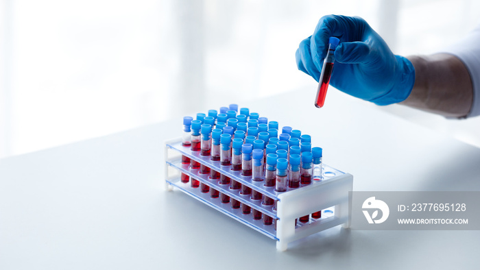 Lab assistant, a medical scientist, a chemistry researcher holds a glass tube through the blood sample, does a chemical experiment and examines a patient’s blood sample. Medicine and research concept.