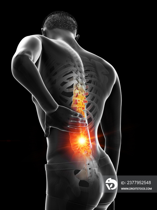 3d rendered medically accurate illustration of a mans painful back