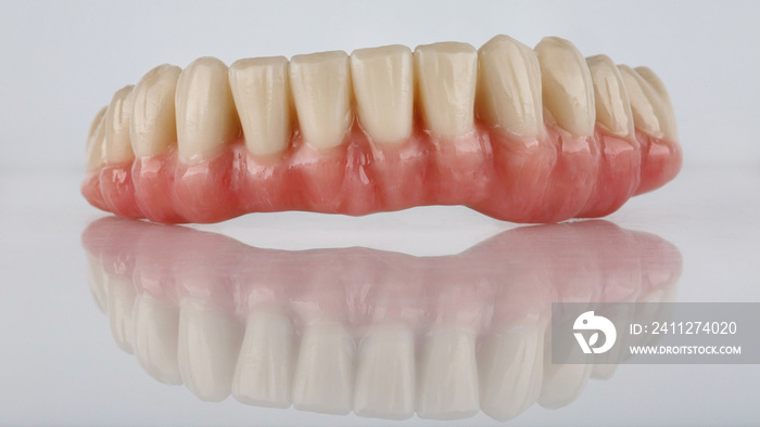 excellent dental prosthesis made of ceramics of the lower jaw with a beautiful gum on a white background