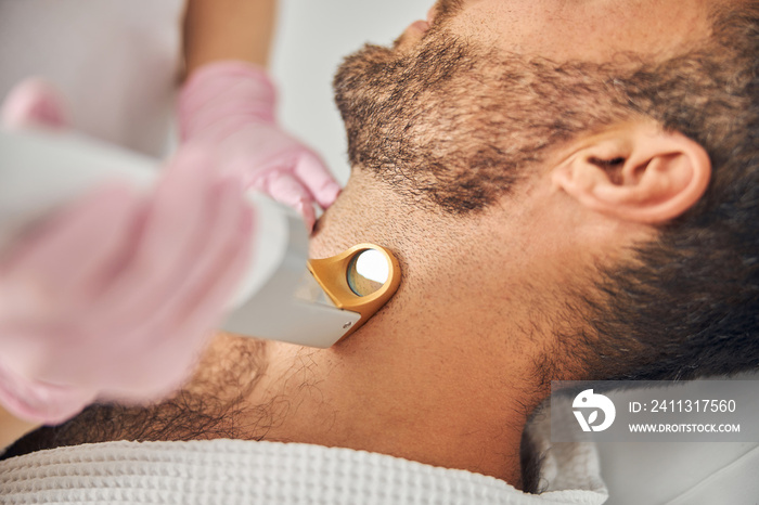 Bearded young man undergoing laser hair removal procedure