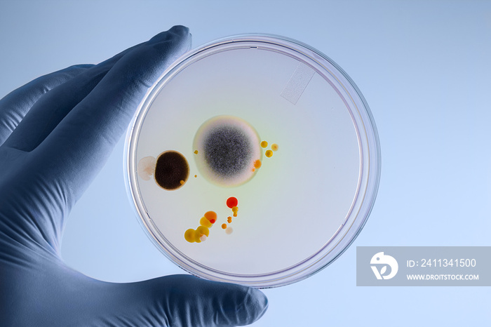 technician hand holding petri dish with microbes culture in the lab / Hand of a microbiologist holding a petri plate with growth of bacteria in the laboratory