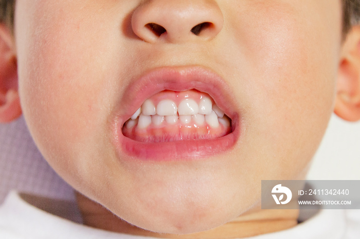 white teeth of a child isolated on a white background