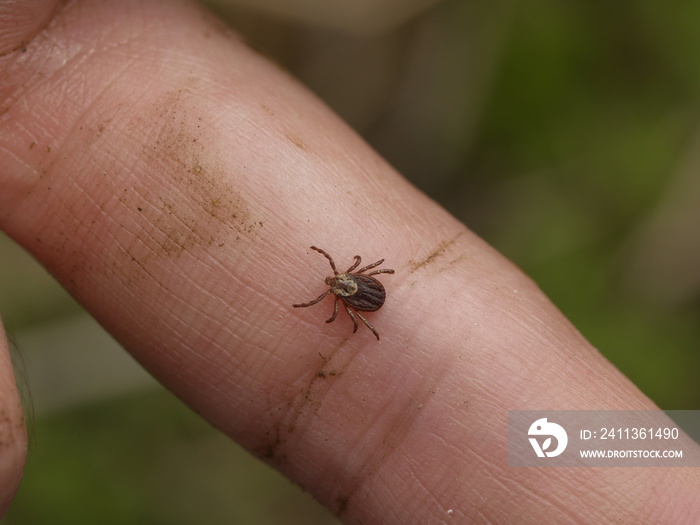 giant tick on a finger