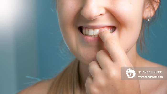 Young woman picking dirt and food leftovers from her teeth with fingers