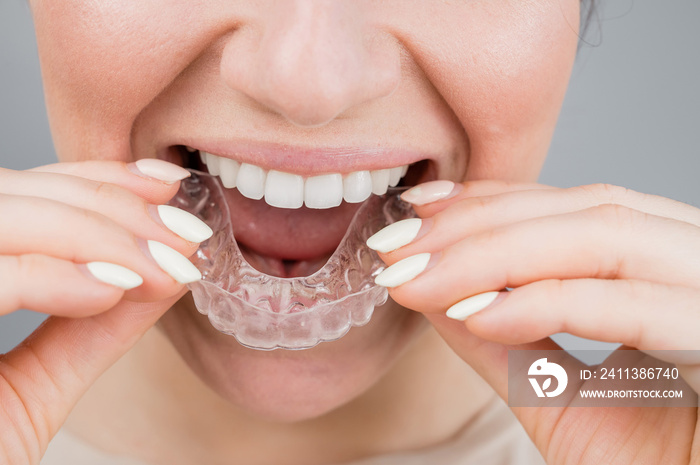 Close-up portrait of a woman putting on a transparent plastic retainer. A girl corrects a bite with the help of an orthodontic device