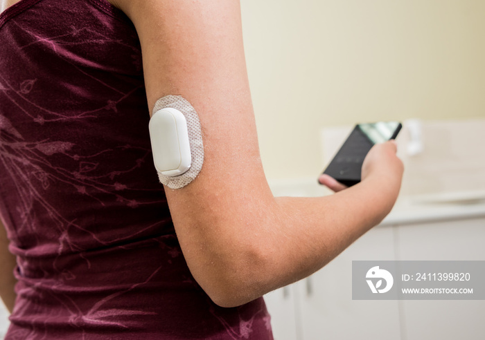 Medical device for glucose check. Continuous glucose monitoring pod.