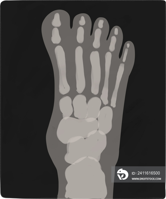 Diverse Xrays Foot