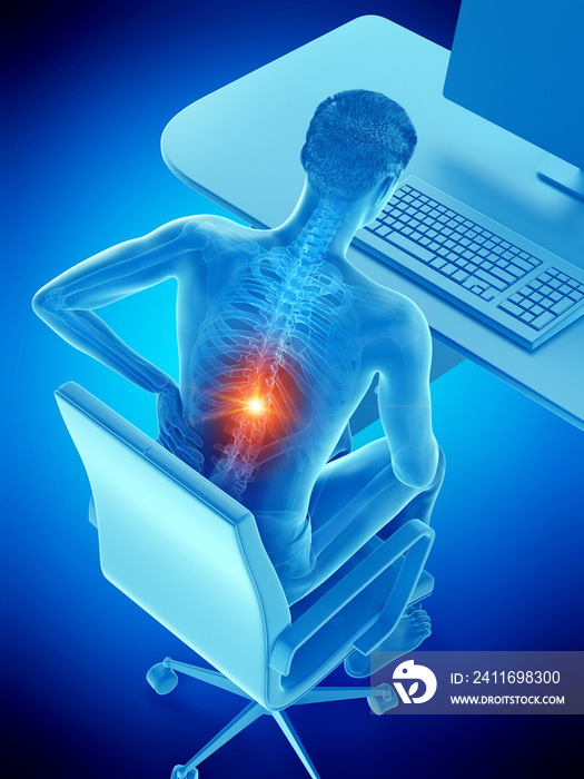 一名男子因坐着而背痛的3d医学精确图示