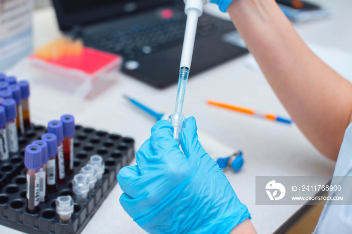 Blood test in the laboratory. Laboratory assistant working with the dispenser. Vacuum tubes with blood