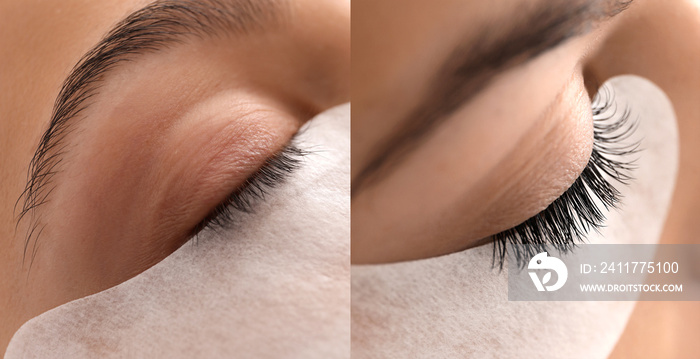 Young woman undergoing eyelash extension procedure in beauty salon, closeup