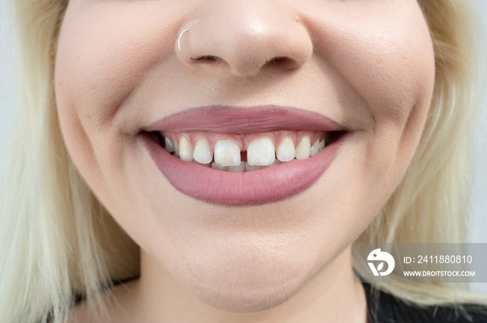 Girl with gap between teeth