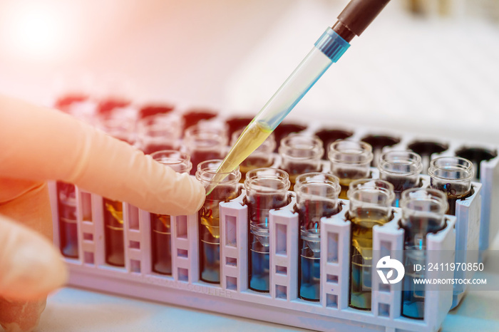 Scientist working with blood sample in laboratory