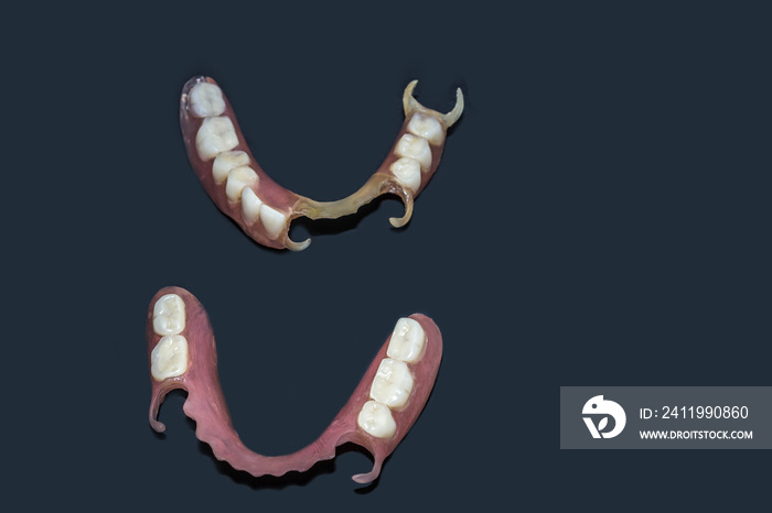 Removable dentures flexible, devoid of nylon, hypoallergenic exempt from monomer.