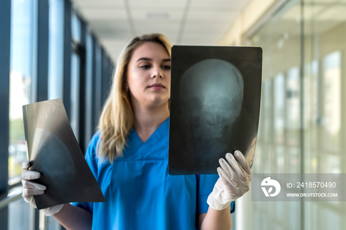 medical worker looks at xray film of the skull to detect signs of the disease