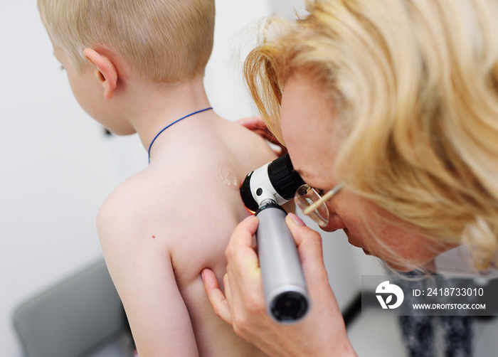 the doctor examines the special medical device moles child