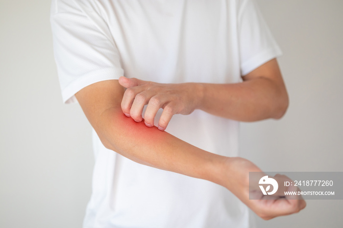 man itching and scratching on arm from itchy dry skin eczema dermatitis