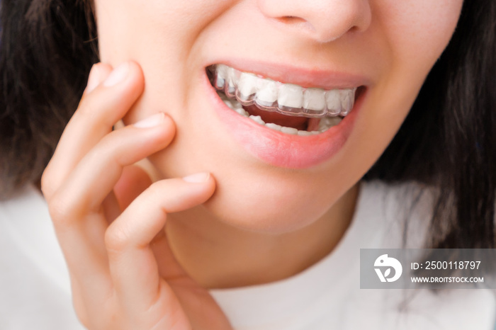 Cheerful young woman watching into the mirror in transparent aligners for straightening and whitening teeth. Removable braces for correction of bite