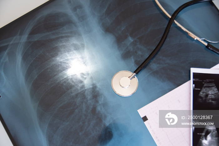 Covid 19 diagnosis with lung x-ray, doctor and stethoscope. Selected focus stethoscope and lung x-ray light part.