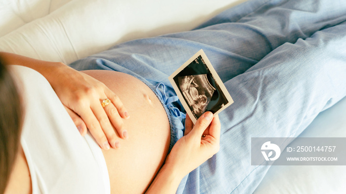 Ultrasound photo pregnancy baby. Woman holding ultrasound pregnant picture. Concept maternity, pregnancy, childbirth.