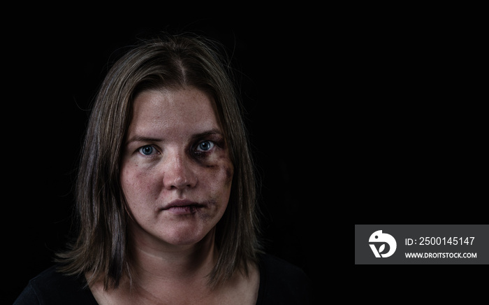 Portrait of the woman victim of domestic violence and abuse. Isolated on dark background. Empty space for text