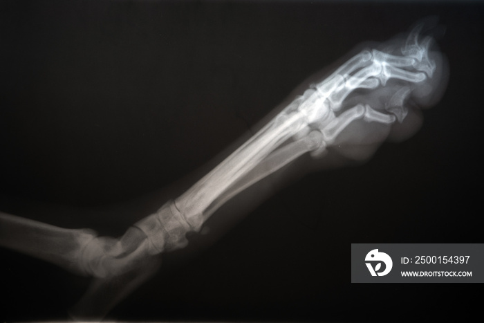 Radiography of a dog paw. Real x ray image of an injured dog paw .