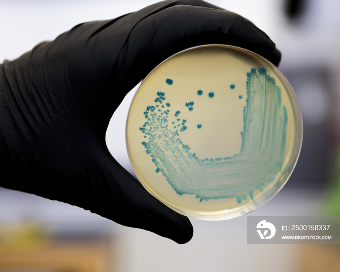 Food safety pathogen Listeria monocytogenes isolated on agar from a food sample.