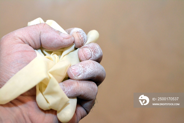 Selective focus of a human hand with a cornstarch powder clinging the skin from a worn medical powdered latex gloves causing allergy and hypersensitivity, powdered gloves are banned from usage by FDA