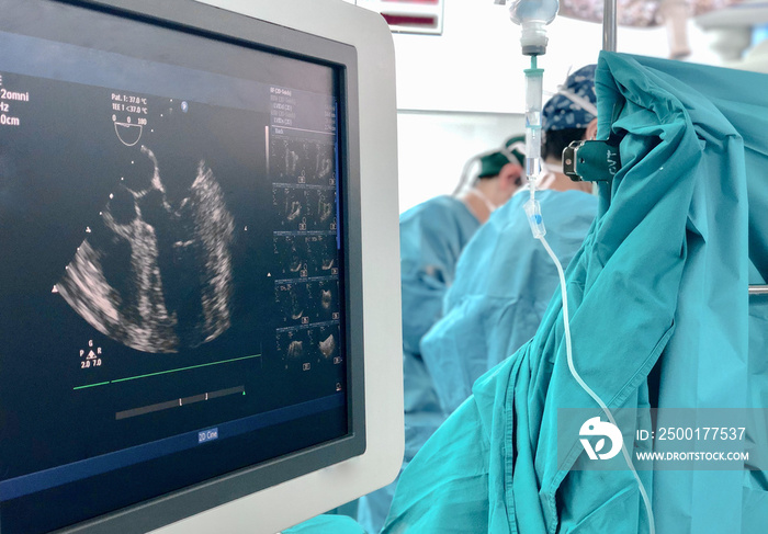 Transesophageal Echocardiography (TEE) during open heart surgery.