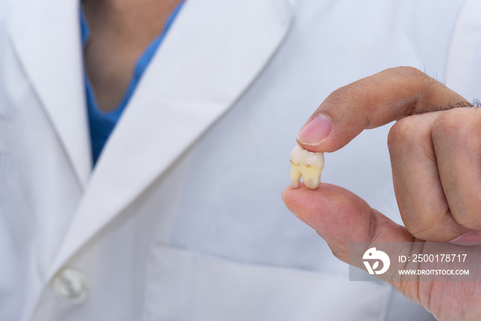 Dentist holding an extracted wisdom tooth