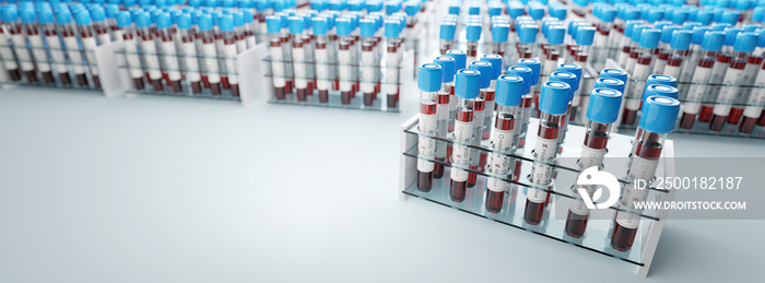 Coronavirus Covid19 test tubes in a rack. Medical screening and Covid tests production